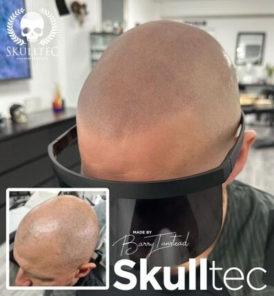 Skull Tec Scalp Micropigmentation